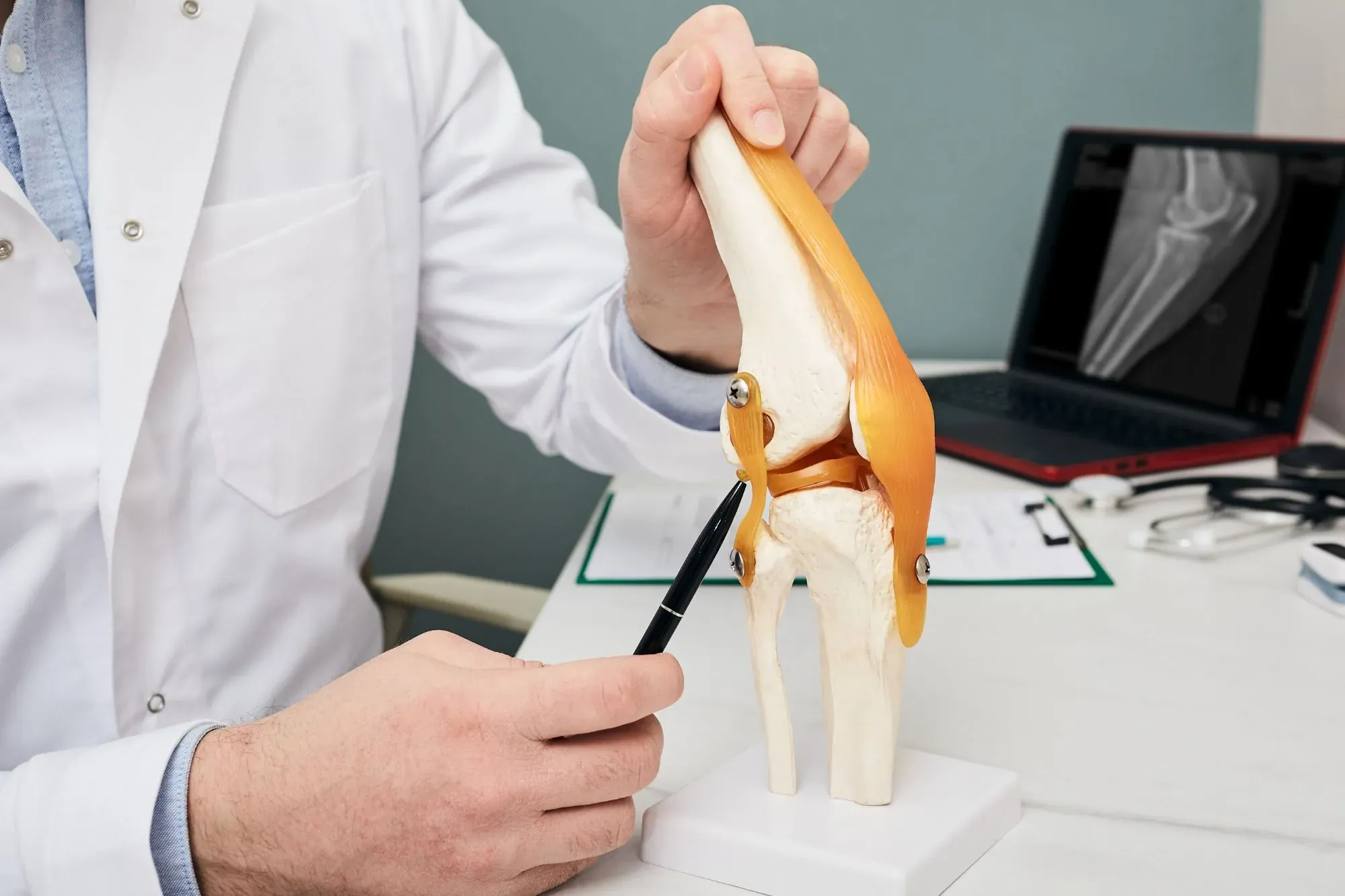 Osteoartrose